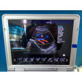 3D-4D-Baby-Farb-Doppler-Ultraschall und Echtzeit-3D-Scanner